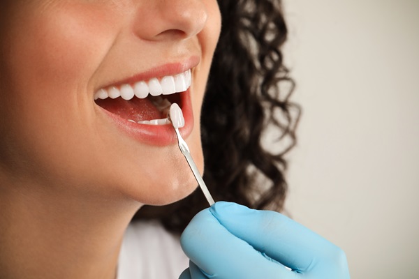 Ask A Cosmetic Dentist: Bonding Vs Veneers