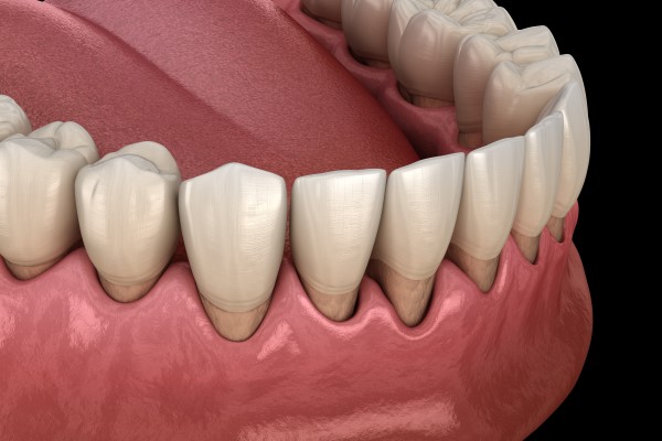 How Adding A Deep Cleaning Toothbrush To Your Oral Hygiene Routine Can Fight Off Gum Disease